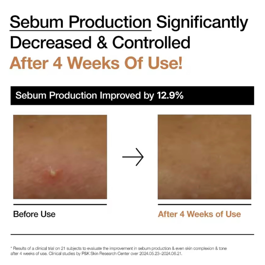 Anua Rice 70 Glow Milky Toner 250ml